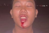 Foto dugaan korban kekerasan fisik , pelaku dilaporkan ke polisi namun belum ada tindak lanjut. 