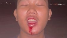 Foto dugaan korban kekerasan fisik , pelaku dilaporkan ke polisi namun belum ada tindak lanjut. 