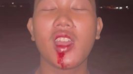 Foto dugaan korban kekerasan fisik , pelaku dilaporkan ke polisi namun belum ada tindak lanjut. 