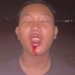 Foto dugaan korban kekerasan fisik , pelaku dilaporkan ke polisi namun belum ada tindak lanjut. 