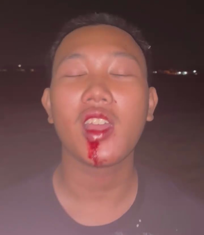 Foto dugaan korban kekerasan fisik , pelaku dilaporkan ke polisi namun belum ada tindak lanjut. 
